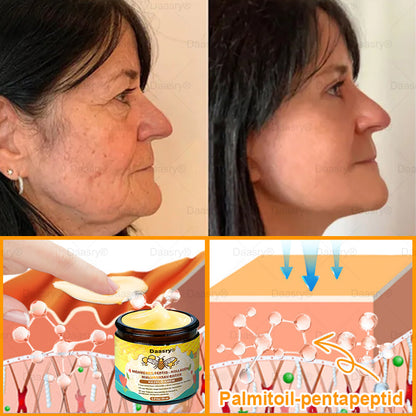 Világszerte legkelendőbb termékek-Daasry® Méhméreg Kezelő Krém, méhméreg peptidekkel, botulinum toxinnal, hialuronsavval és kollagénnel💧. Hatékonyan küzd a ráncok, finom vonalak, megereszkedés, terhességi csíkok és sötét foltok ellen !