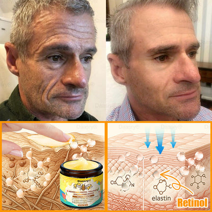 Világszerte legkelendőbb termékek-Daasry® Méhméreg Kezelő Krém, méhméreg peptidekkel, botulinum toxinnal, hialuronsavval és kollagénnel💧. Hatékonyan küzd a ráncok, finom vonalak, megereszkedés, terhességi csíkok és sötét foltok ellen !