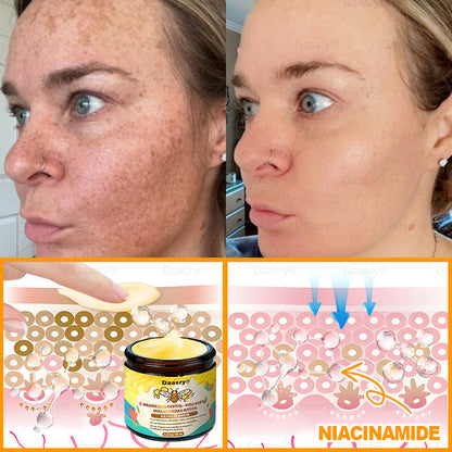 Világszerte legkelendőbb termékek-Daasry® Méhméreg Kezelő Krém, méhméreg peptidekkel, botulinum toxinnal, hialuronsavval és kollagénnel💧. Hatékonyan küzd a ráncok, finom vonalak, megereszkedés, terhességi csíkok és sötét foltok ellen !