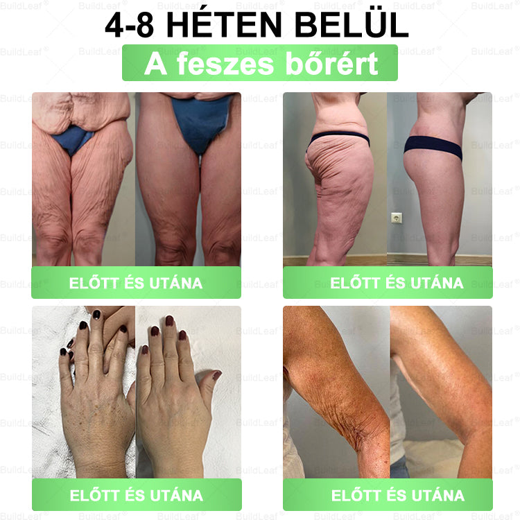 𝑯𝒊𝒗𝒂𝒕𝒂𝒍𝒐𝒔 𝒐𝒍𝒅𝒂𝒍 | 𝑩𝒖𝒊𝒍𝒅𝑳𝒆𝒂𝒇® 𝑮𝑳𝑷-120-𝒊𝒏-1 𝑺𝒍𝒊𝒎 & 𝑯𝒆𝒂𝒍𝒕𝒉 𝒔𝒛á𝒋𝒐𝒏 á𝒕 𝒔𝒛𝒆𝒅𝒉𝒆𝒕ő 𝒐𝒍𝒅𝒂𝒕– napi egy adag, és már 7 nap alatt látható a változás .Segít a túlsúly, a szív- és érrendszeri problémák, a cukorbetegség, az alvási apnoe, a bélrendszeri gondok és
