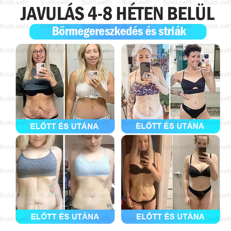 Buildleaf® Tirzepatide Nano Mikrotűs Párna Kollagénnel és Matrixyl 3000-al | Célzottan az elhízás, laza bőr, magas vérnyomás, cukorbetegség, zsírmáj, ízületi fájdalom, agyi köd, alacsony energia, testfájdalmak és egyéb problémák kezelésére