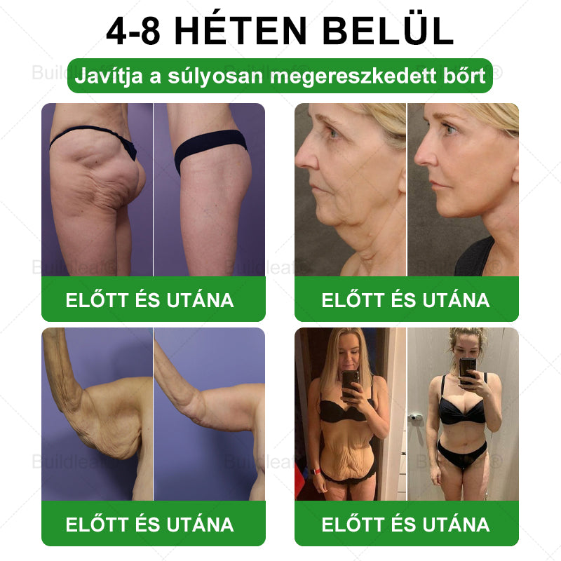 BuildLeaf® GLP-1 6 az 1-ben egészségügyi oldat szájon át szedhető folyadék ✅ Elhízás, szív- és érrendszeri egészség, cukorbetegség, alvási apnoe, bélrendszeri egészség, ízületi problémák és egyebek esetén