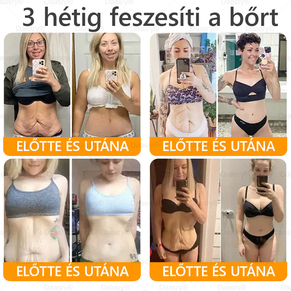 Világszerte legkelendőbb termékek-Daasry® Méhméreg Kezelő Krém, méhméreg peptidekkel, botulinum toxinnal, hialuronsavval és kollagénnel💧. Hatékonyan küzd a ráncok, finom vonalak, megereszkedés, terhességi csíkok és sötét foltok ellen !