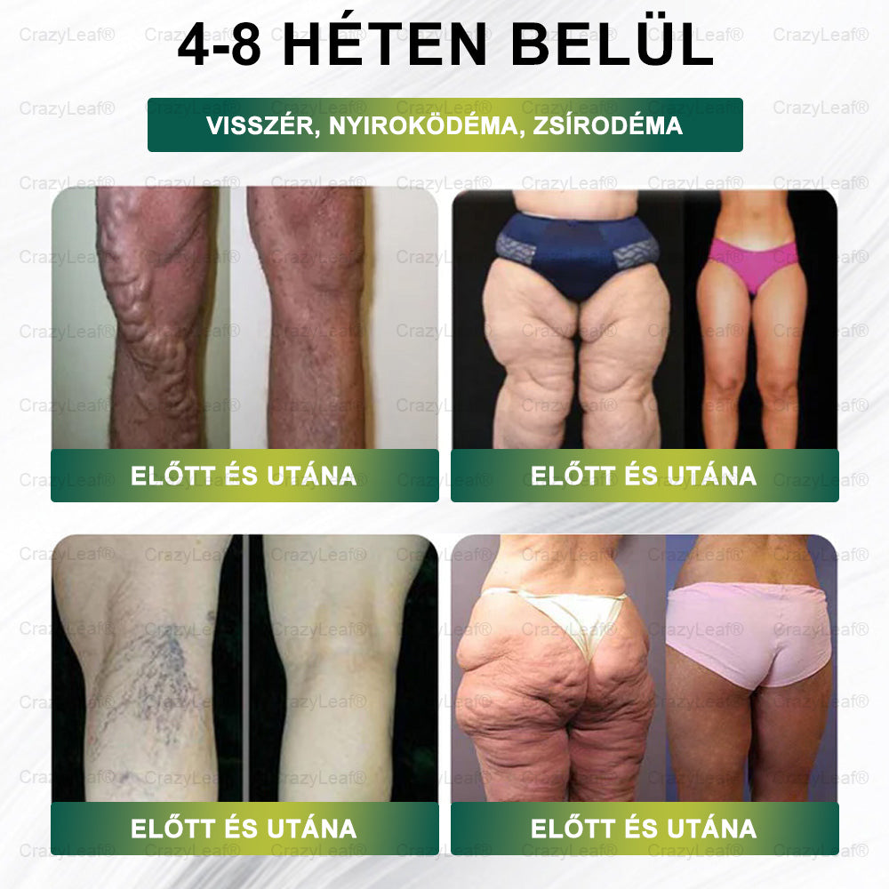 CrazyLeaf® Meglutide GLP-1 Aktiváló Orális Oldat – Moringa • NAD+ • Yerba Mate – Természetes támogatás fogyáshoz, öregedésgátláshoz és cukoranyagcseréhez