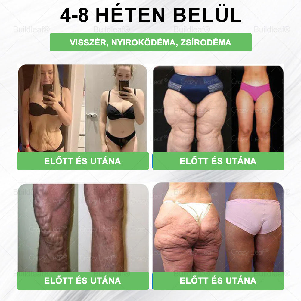 BuildLeaf® GLP-1 6 az 1-ben egészségügyi oldat szájon át szedhető folyadék ✅ Elhízás, szív- és érrendszeri egészség, cukorbetegség, alvási apnoe, bélrendszeri egészség, ízületi problémák és egyebek esetén