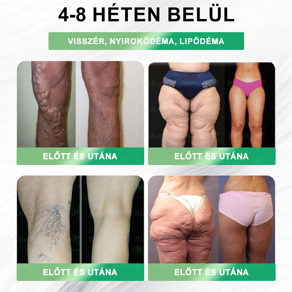 𝑩𝒖𝒊𝒍𝒅𝑳𝒆𝒂𝒇® 𝑮𝑳𝑷-1 8-𝒊𝒏-1 𝑭𝒊𝒕 & 𝑽𝒊𝒕𝒂𝒍 𝑺𝒛á𝒋𝒉𝒊𝒈𝒊é𝒏𝒊𝒂𝒊 𝑶𝒍𝒅𝒂𝒕 ✅ 𝑨𝒍𝒌𝒂𝒍𝒎𝒂𝒔 𝒆𝒍𝒉í𝒛á𝒔, 𝒔𝒛í𝒗- é𝒔 é𝒓𝒓𝒆𝒏𝒅𝒔𝒛𝒆𝒓𝒊 𝒆𝒈é𝒔𝒛𝒔é𝒈, 𝒄𝒖𝒌𝒐𝒓𝒃𝒆𝒕𝒆𝒈𝒔é𝒈, 𝒂𝒍𝒗á𝒔𝒊 𝒂𝒑𝒏𝒐𝒆, 𝒃é𝒍𝒓𝒆𝒏𝒅𝒔𝒛𝒆𝒓𝒊 𝒆𝒈é𝒔𝒛𝒔é𝒈, í𝒛ü𝒍𝒆𝒕𝒊 𝒑𝒓𝒐𝒃𝒍é𝒎á𝒌 é𝒔 𝒆𝒈𝒚é𝒃 𝒆𝒈é𝒔𝒛𝒔é𝒈ü𝒈𝒚𝒊 𝒊𝒈é𝒏𝒚𝒆𝒌 𝒆𝒔𝒆𝒕é𝒏
