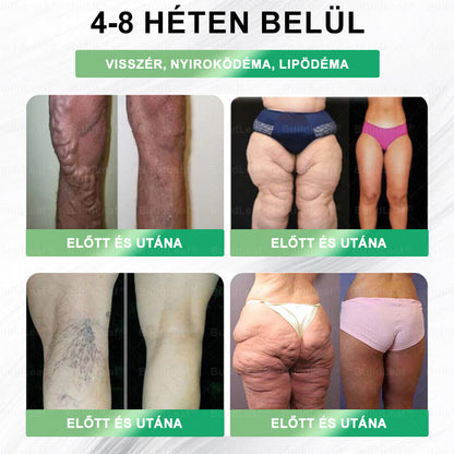 𝑩𝒖𝒊𝒍𝒅𝑳𝒆𝒂𝒇® 𝑮𝑳𝑷-1 8-𝒊𝒏-1 𝑭𝒊𝒕 & 𝑽𝒊𝒕𝒂𝒍 𝑺𝒛á𝒋𝒉𝒊𝒈𝒊é𝒏𝒊𝒂𝒊 𝑶𝒍𝒅𝒂𝒕 ✅ 𝑨𝒍𝒌𝒂𝒍𝒎𝒂𝒔 𝒆𝒍𝒉í𝒛á𝒔, 𝒔𝒛í𝒗- é𝒔 é𝒓𝒓𝒆𝒏𝒅𝒔𝒛𝒆𝒓𝒊 𝒆𝒈é𝒔𝒛𝒔é𝒈, 𝒄𝒖𝒌𝒐𝒓𝒃𝒆𝒕𝒆𝒈𝒔é𝒈, 𝒂𝒍𝒗á𝒔𝒊 𝒂𝒑𝒏𝒐𝒆, 𝒃é𝒍𝒓𝒆𝒏𝒅𝒔𝒛𝒆𝒓𝒊 𝒆𝒈é𝒔𝒛𝒔é𝒈, í𝒛ü𝒍𝒆𝒕𝒊 𝒑𝒓𝒐𝒃𝒍é𝒎á𝒌 é𝒔 𝒆𝒈𝒚é𝒃 𝒆𝒈é𝒔𝒛𝒔é𝒈ü𝒈𝒚𝒊 𝒊𝒈é𝒏𝒚𝒆𝒌 𝒆𝒔𝒆𝒕é𝒏