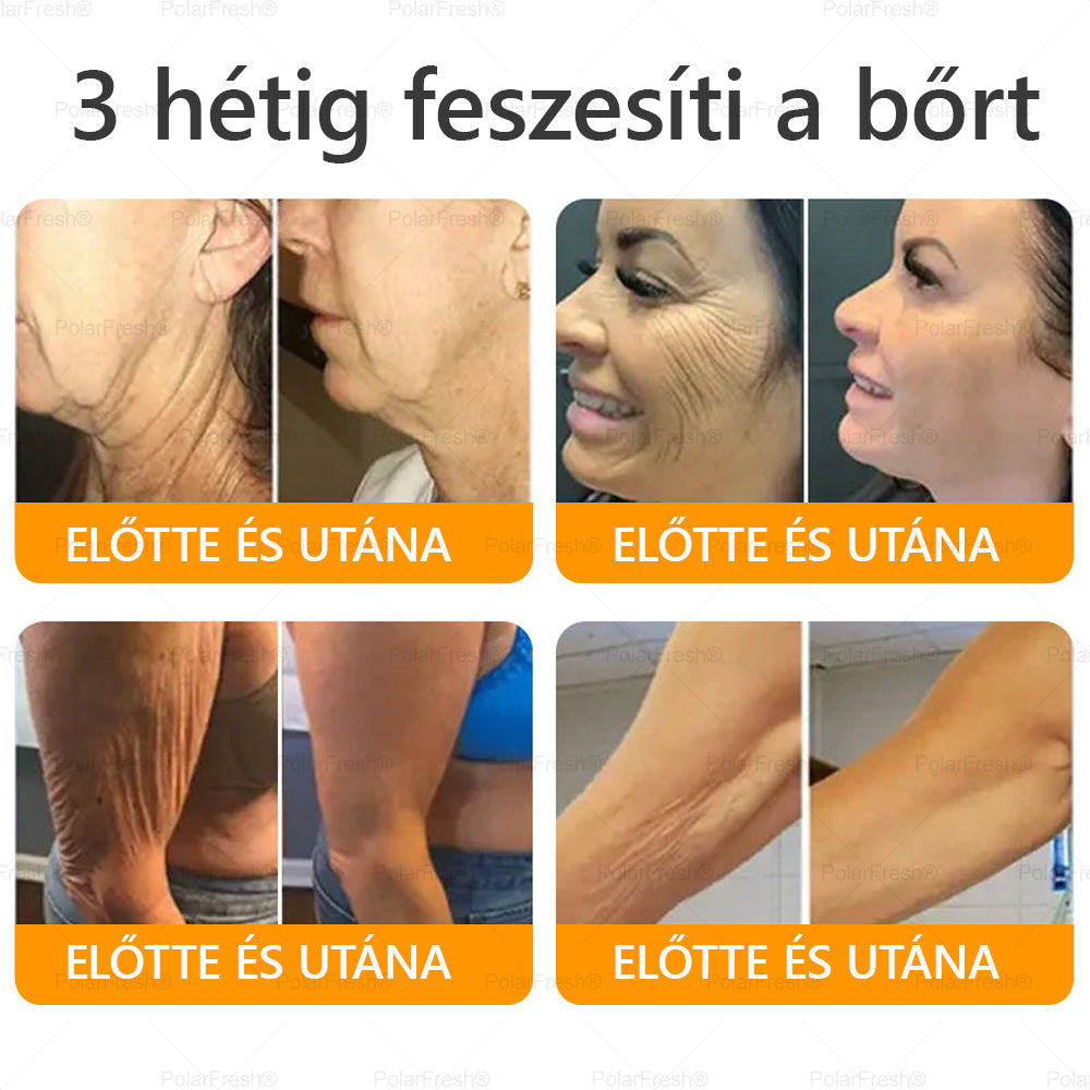 Világszerte legkelendőbb termékek-Daasry® Méhméreg Kezelő Krém, méhméreg peptidekkel, botulinum toxinnal, hialuronsavval és kollagénnel💧. Hatékonyan küzd a ráncok, finom vonalak, megereszkedés, terhességi csíkok és sötét foltok ellen !