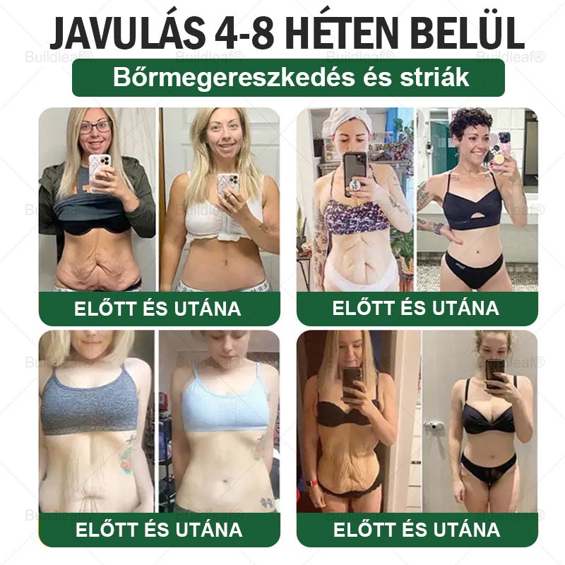 BuildLeaf® GLP-1 6 az 1-ben egészségügyi oldat szájon át szedhető folyadék ✅ Elhízás, szív- és érrendszeri egészség, cukorbetegség, alvási apnoe, bélrendszeri egészség, ízületi problémák és egyebek esetén