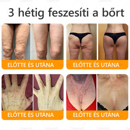 Világszerte legkelendőbb termékek-Daasry® Méhméreg Kezelő Krém, méhméreg peptidekkel, botulinum toxinnal, hialuronsavval és kollagénnel💧. Hatékonyan küzd a ráncok, finom vonalak, megereszkedés, terhességi csíkok és sötét foltok ellen !